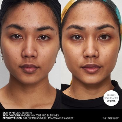 The INKEY List 15% Vitamin C and EGF Brightening Serum - Imagen 3