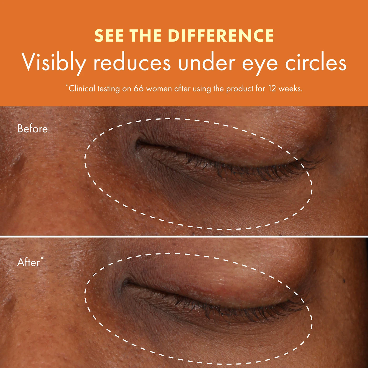 Origins Ginzing™ Vitamin C Eye Cream to Brighten and Depuff (Original / Cool) - Imagen 4