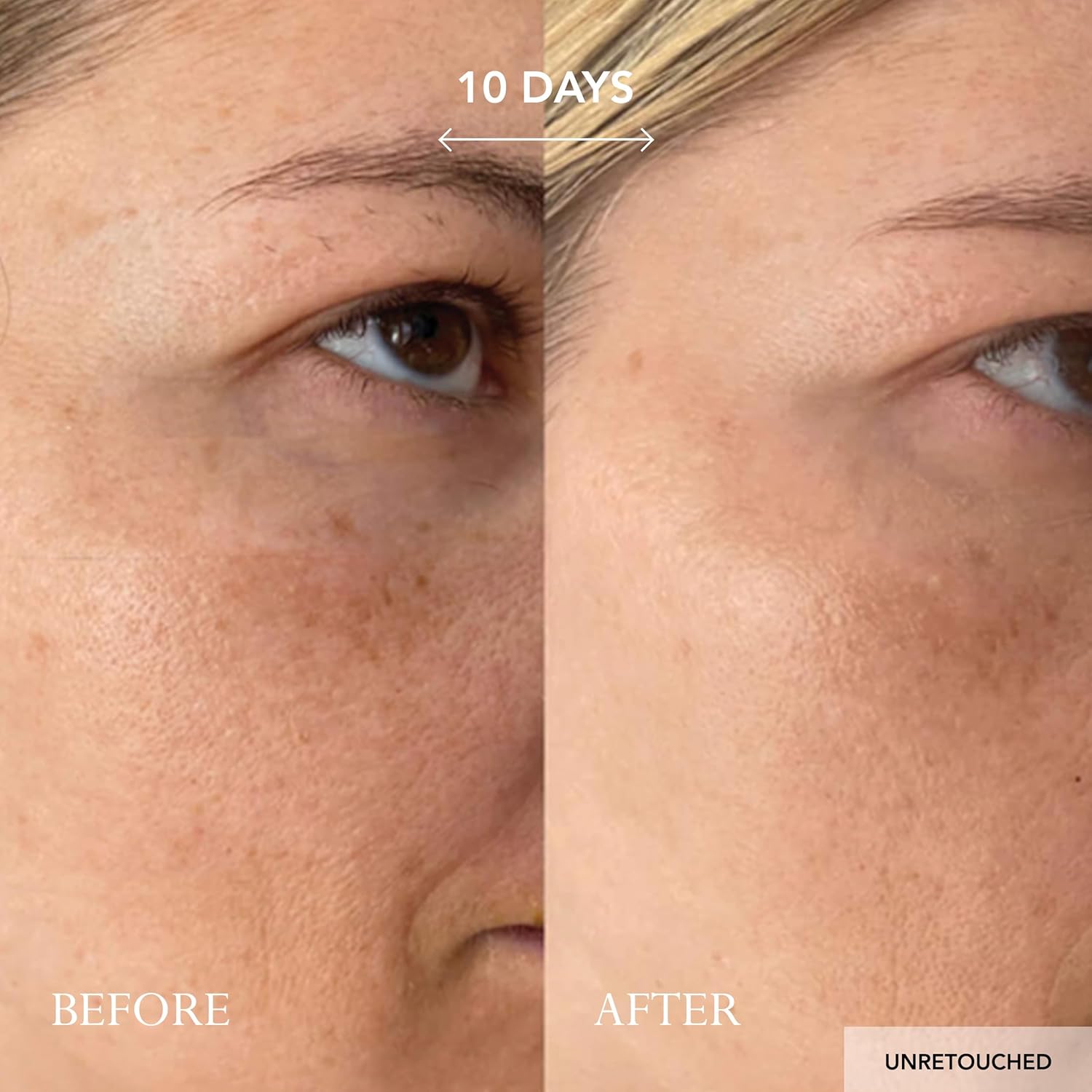 KAT BURKI Vitamin C Intensive Face Cream 30ML - Imagen 2