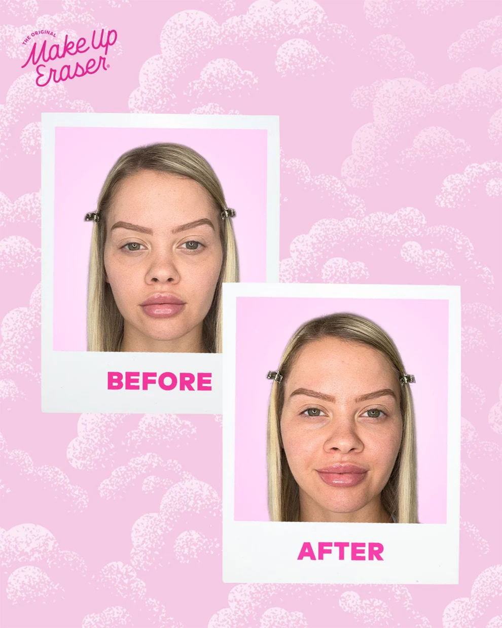 Make Up Eraser Cooling Clouds Face Patches - Imagen 4