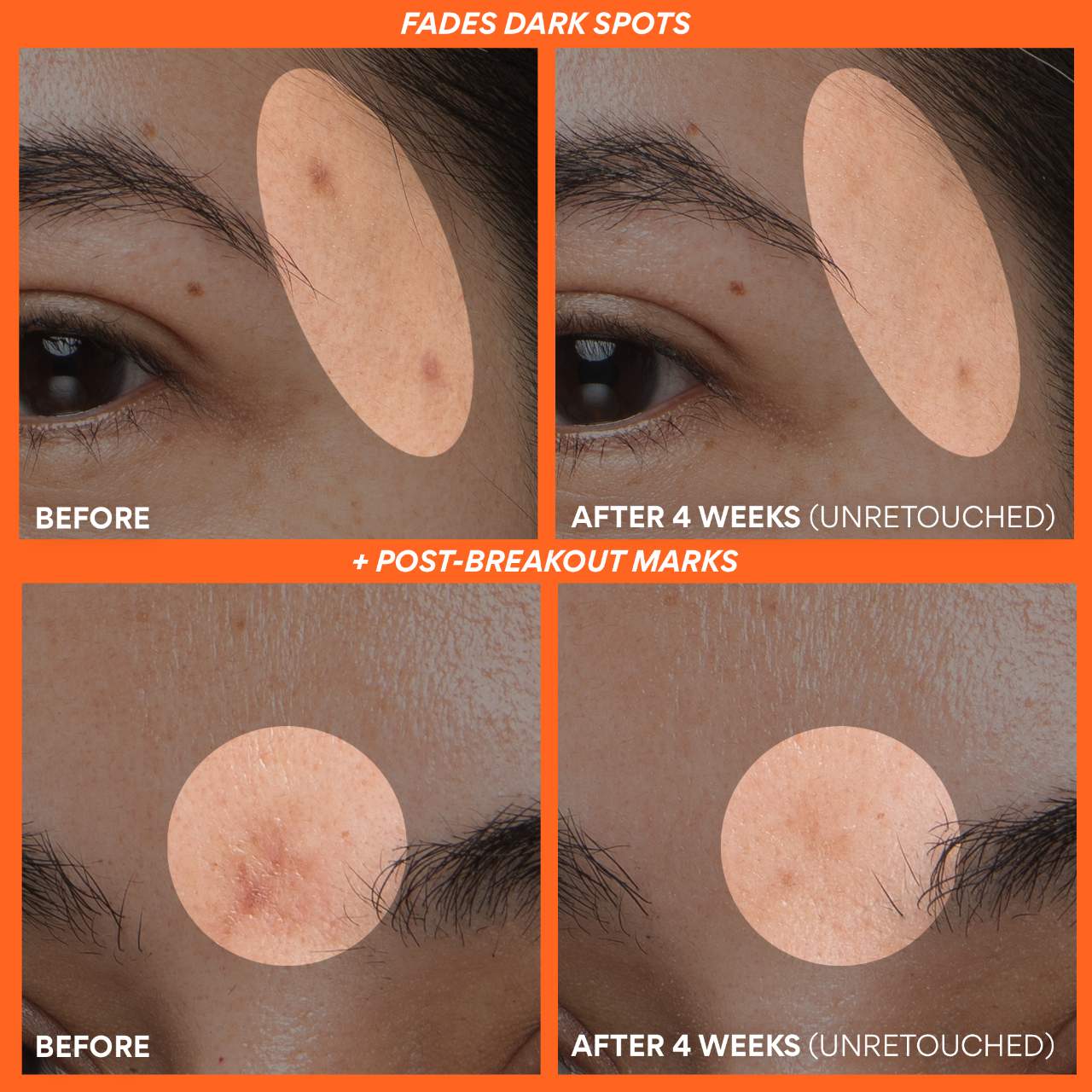 innisfree Rapid Vitamin C Brightening Serum for Dark Spots + Post-Breakout Marks 7ml - Imagen 6